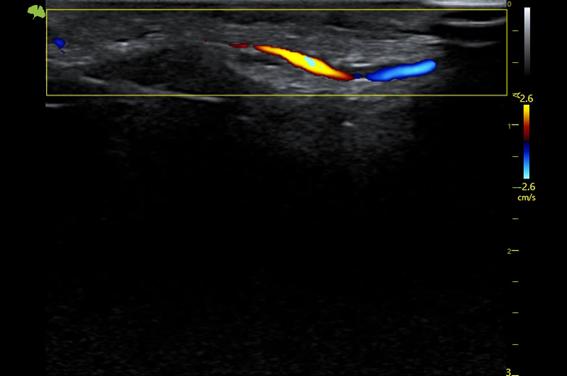 M&aacute;y si&ecirc;u &acirc;m 5D Vinno S300