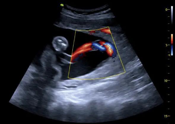 M&aacute;y si&ecirc;u &acirc;m 5D Vinno G65 - Tr&iacute; tuệ nh&acirc;n tạo AI