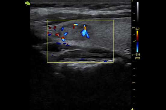 M&aacute;y si&ecirc;u &acirc;m 5D Vinno S300