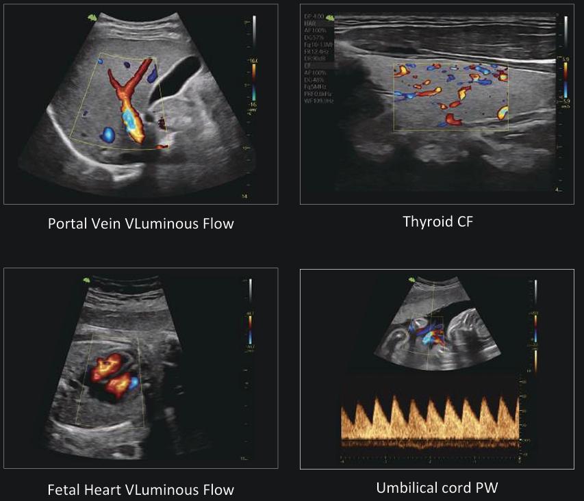 M&aacute;y si&ecirc;u &acirc;m 5D Vinno R500