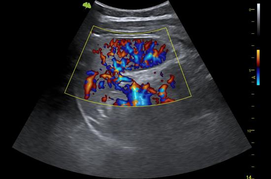 M&aacute;y si&ecirc;u &acirc;m 5D Vinno S300