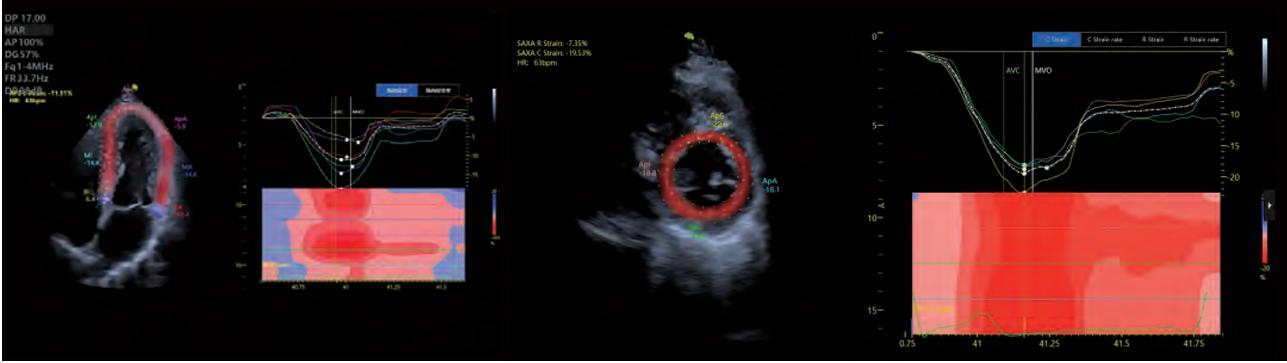M&aacute;y si&ecirc;u &acirc;m Vinno G65
