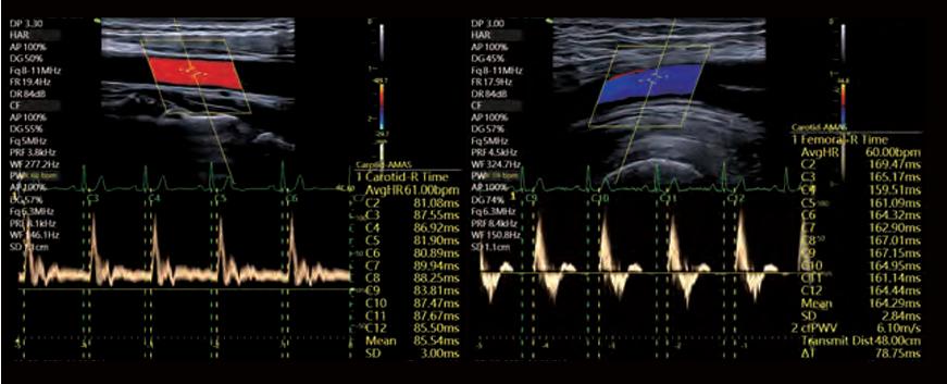M&aacute;y si&ecirc;u &acirc;m Vinno G65