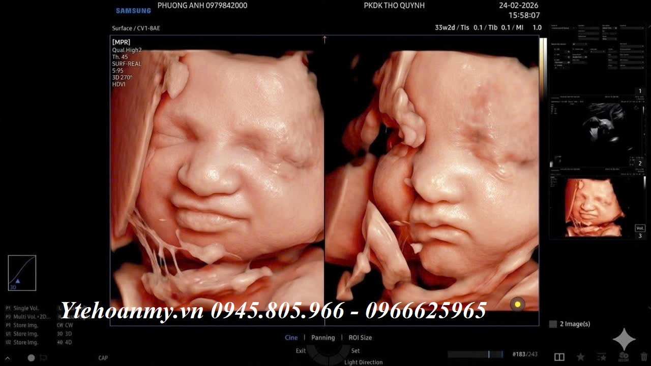 M&aacute;y si&ecirc;u &acirc;m 5D - Tất cả những g&igrave; bạn cần biết trước khi mua