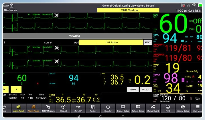 Máy monitor theo dõi bệnh nhân Contec