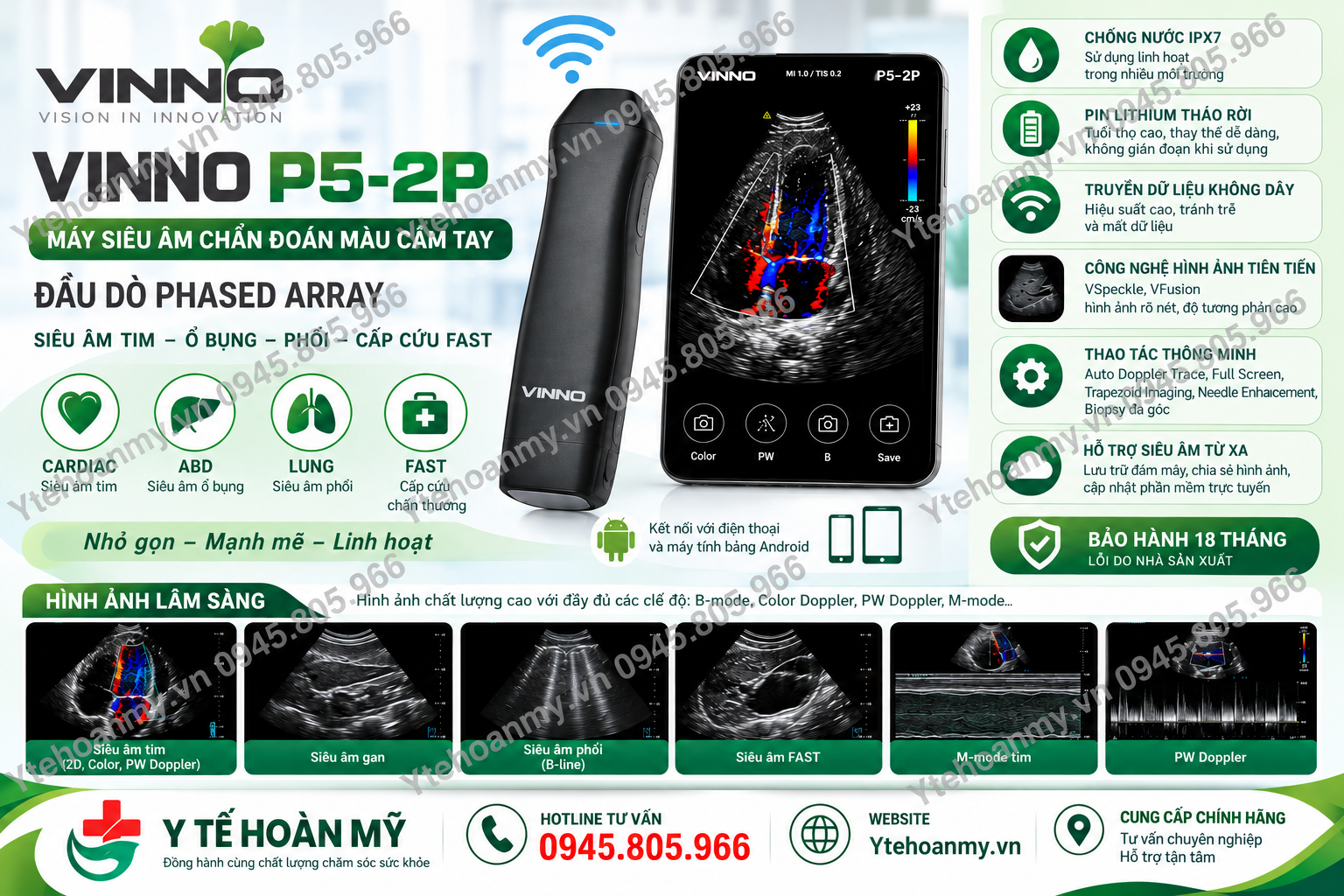 Bảng giá máy siêu âm tim mới nhất - 5 lựa chọn cho bác sĩ mở phòng khám