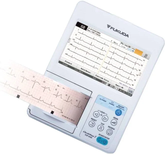 12 đạo trình chuẩn dạng sóng ECG