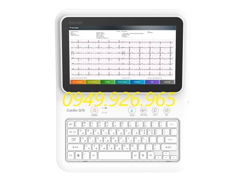 Máy điện tim Ebionet ECG Cardio Q70