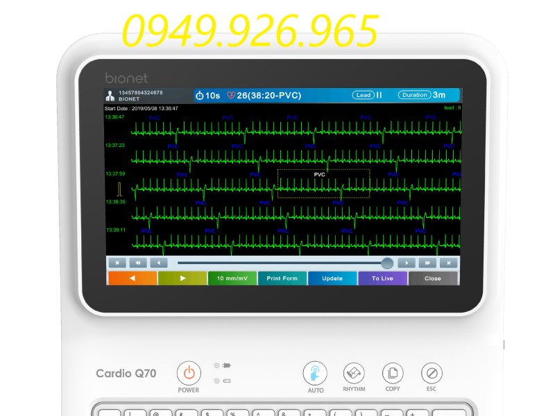Máy điện tim Ebionet ECG Cardio Q70