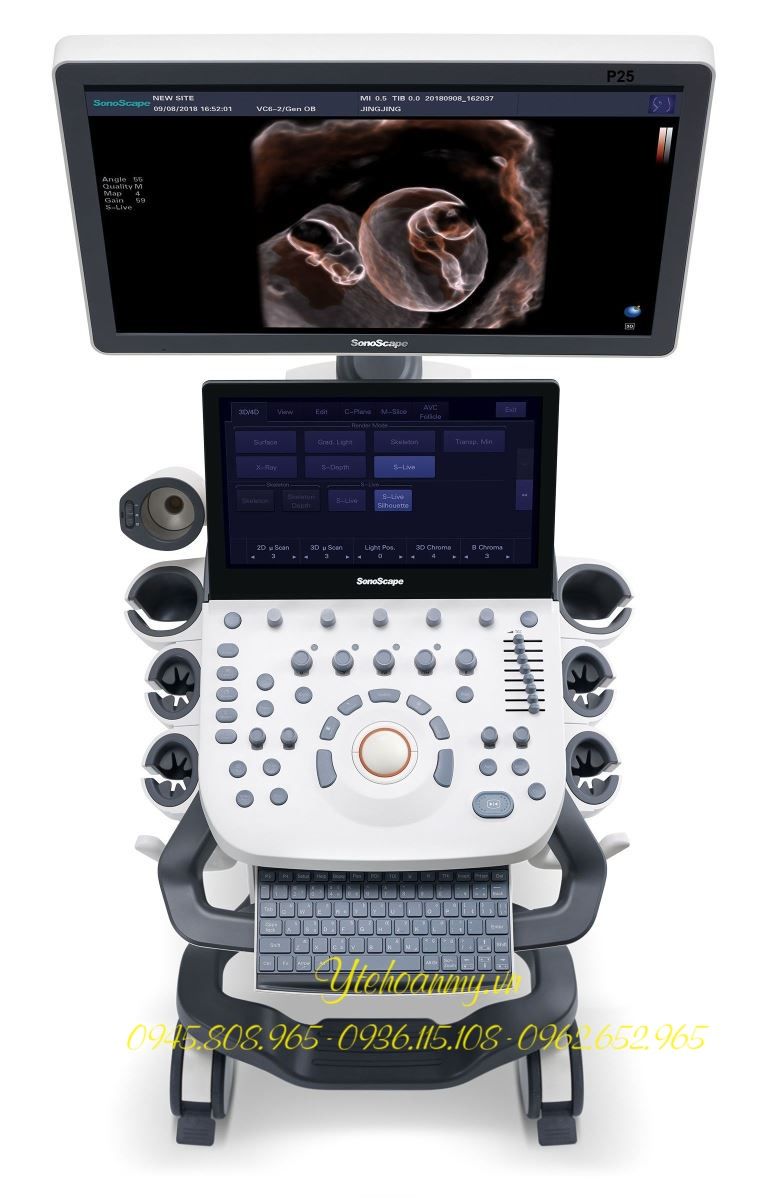 Máy Siêu Âm 5D SonoScape P22, công nghệ Mỹ, Bảo hà