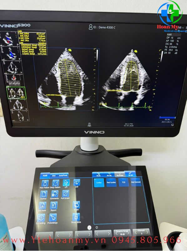 Máy siêu âm 5D Vinno S300