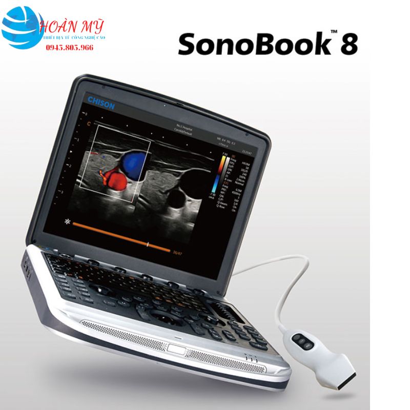 Máy siêu âm xách tay Chison SonoBook 8