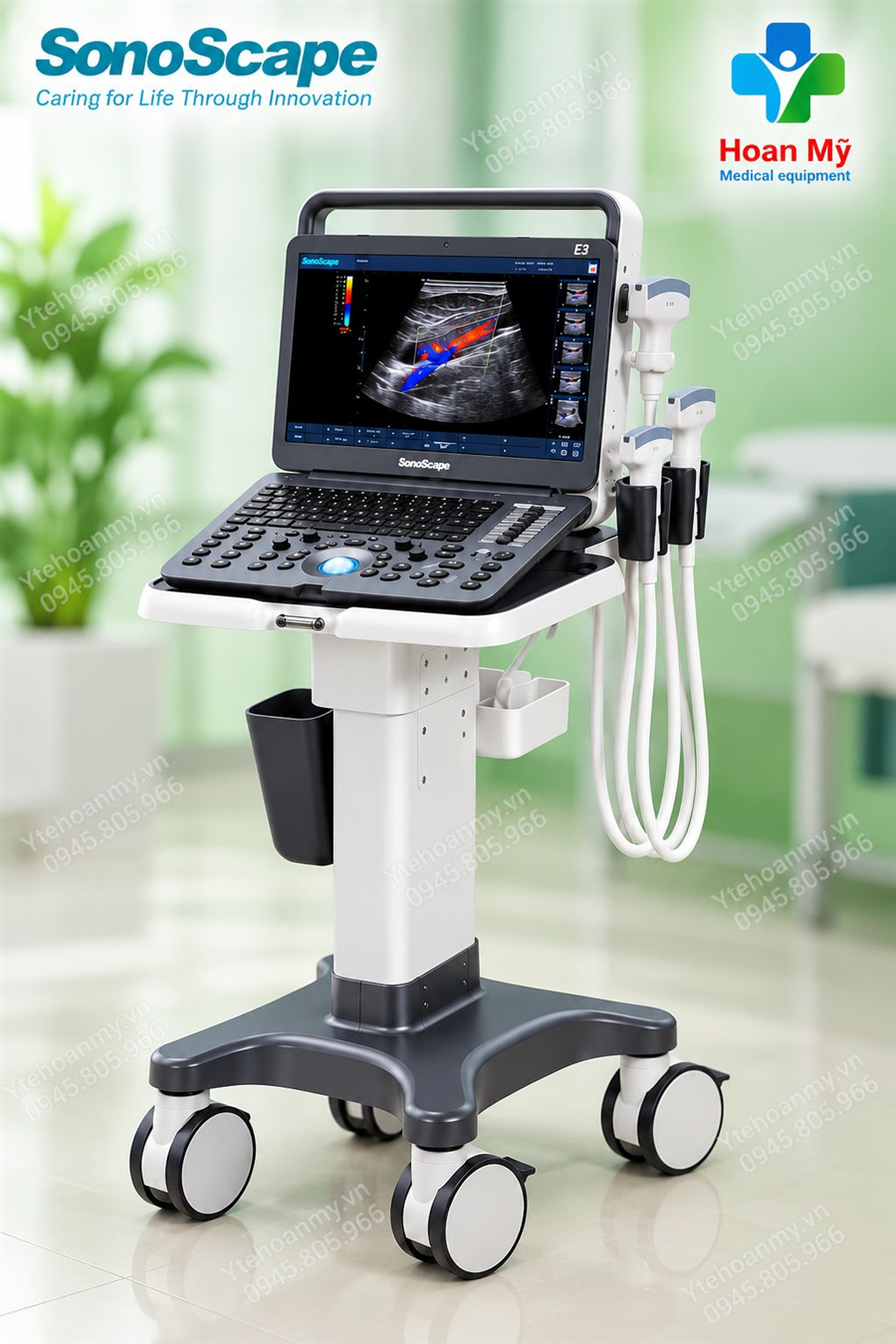 Máy siêu âm xách tay Sonoscape E3, 15.6 inch Full 