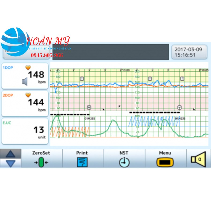 Monitor sản khoa Toitu MT-610