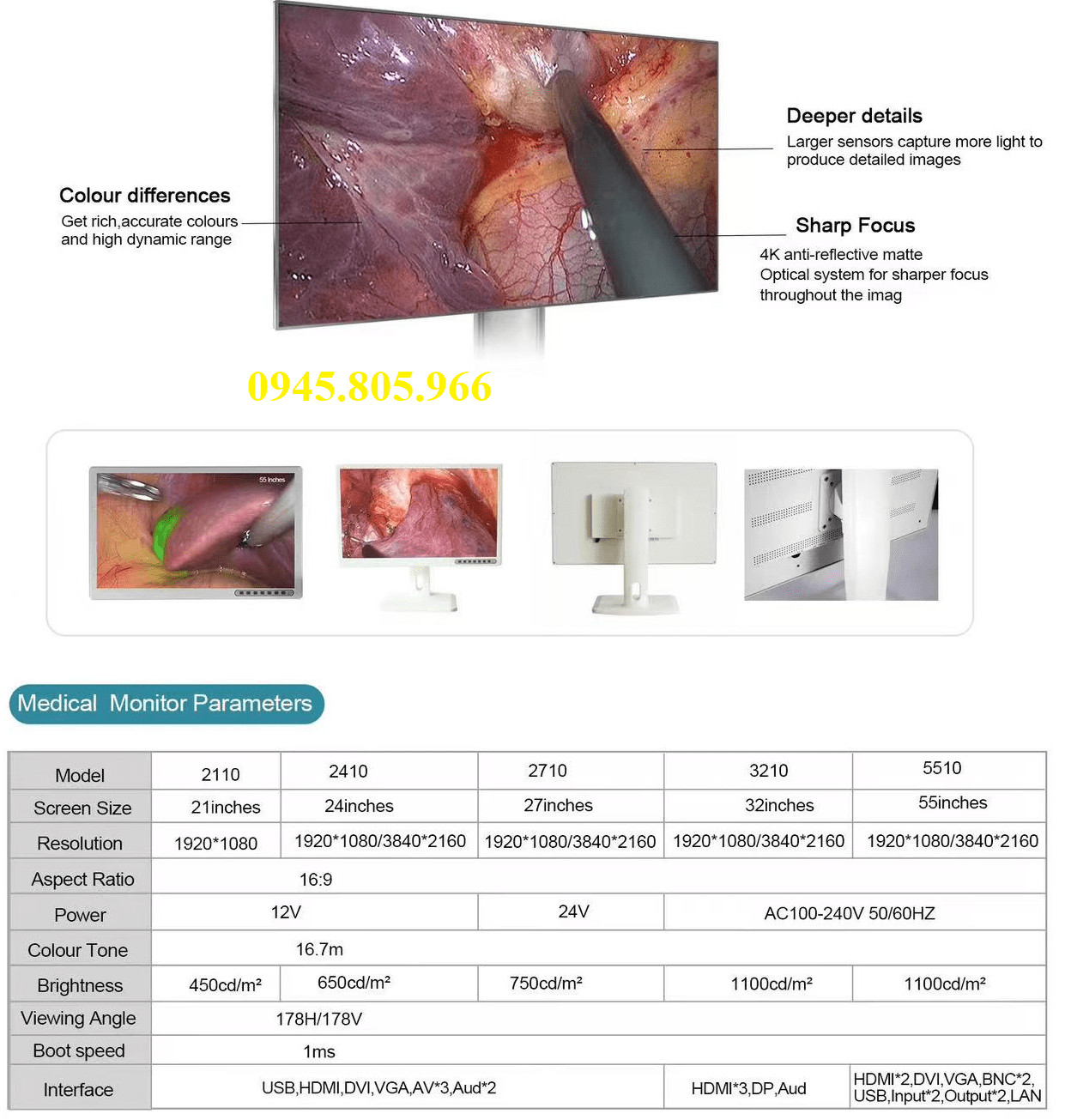 Cấu tạo và nguyên lý hoạt động của máy nội soi tai mũi họng