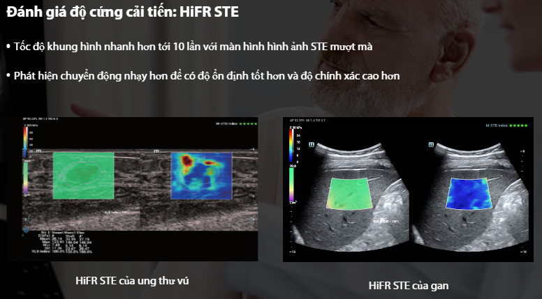 Máy siêu âm 5D Mindray Resona I9