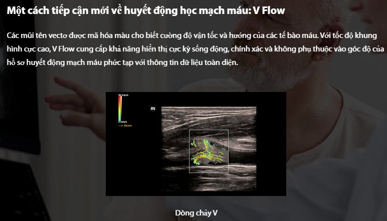 Máy siêu âm 5D Mindray Resona I9