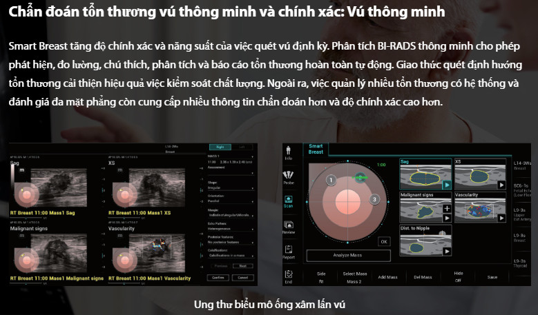 Máy siêu âm 5D Mindray Resona I9