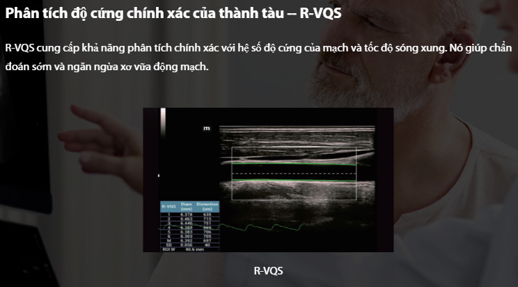 Máy siêu âm 5D Mindray Resona I9