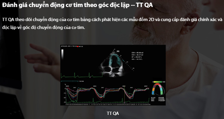 Máy siêu âm 5D Mindray Resona I9