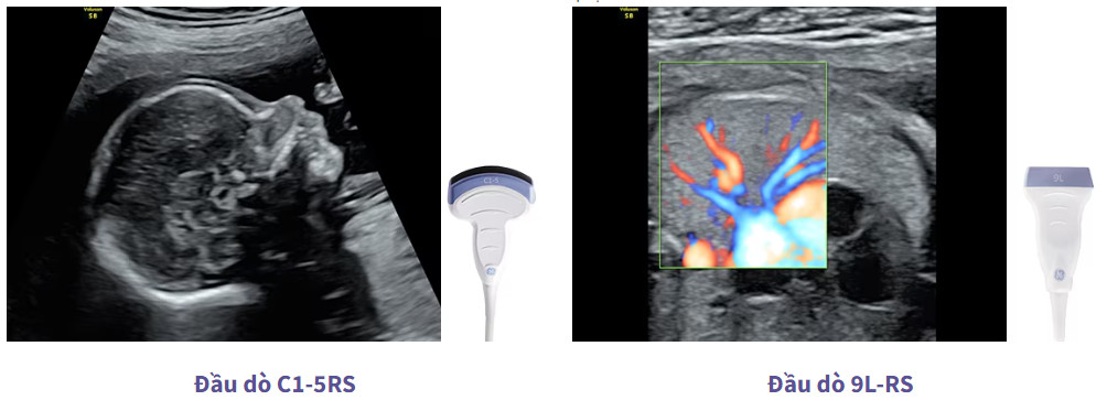 Máy siêu âm sản khoa GE Voluson S8