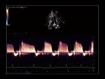 Máy siêu âm 5D Mindray Resona R9 Phiên bản Bạch Kim