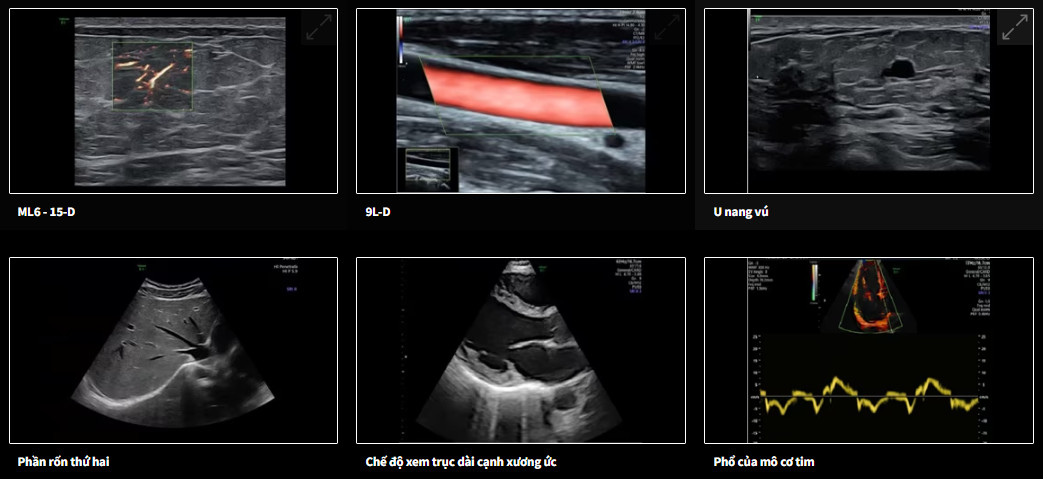 Máy siêu âm sản khoa GE Voluson E6