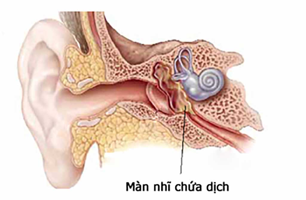 Điều trị viêm tai giữa tại nhà theo mẹo dân gian