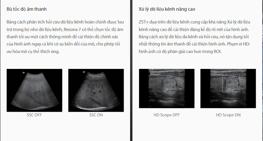 Máy siêu âm 5D Mindray Resona 7