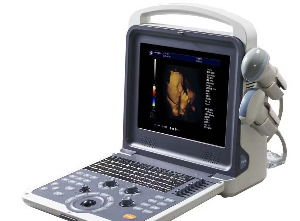 Máy siêu âm Doppler màu Cansonic  K2