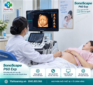 Đánh giá chất lượng Máy siêu âm 6D Sonoscape P60 Exp có đáng dùng hay không?