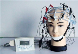 Điện não đồ là gì và những nguyên tắc đo điện não đồ?