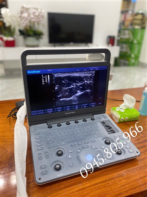 Máy siêu âm cơ xương khớp - Nguyên lý hoạt động và ứng dụng trong siêu âm