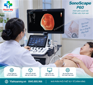Nhận xét từ các chuyên gia về Máy siêu âm 5D Sonoscape P60