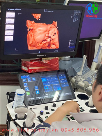 Máy siêu âm 5D Vinno S300