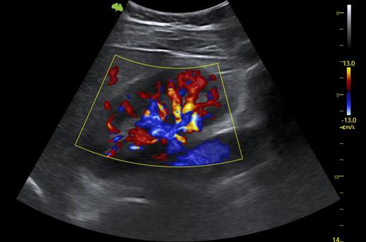 M&aacute;y si&ecirc;u &acirc;m 5D Vinno S300