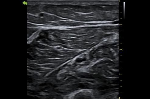 M&aacute;y si&ecirc;u &acirc;m 5D Vinno S300