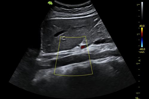 M&aacute;y si&ecirc;u &acirc;m 5D Vinno S300