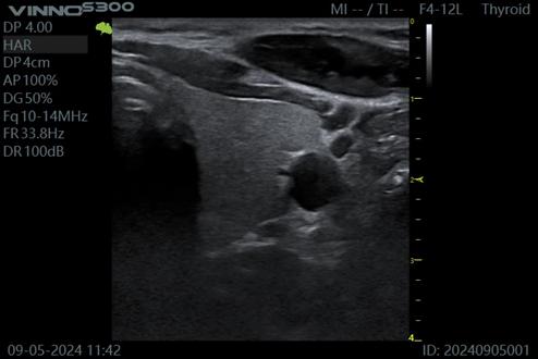 M&aacute;y si&ecirc;u &acirc;m 5D Vinno S300