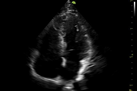 M&aacute;y si&ecirc;u &acirc;m 5D Vinno S100