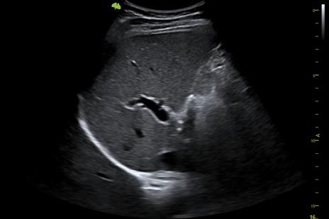 M&aacute;y si&ecirc;u &acirc;m 5D Vinno S100