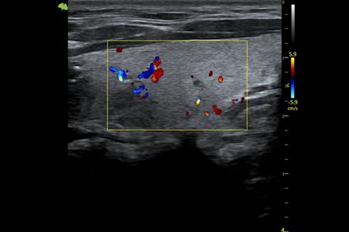 M&aacute;y si&ecirc;u &acirc;m 5D Vinno S100